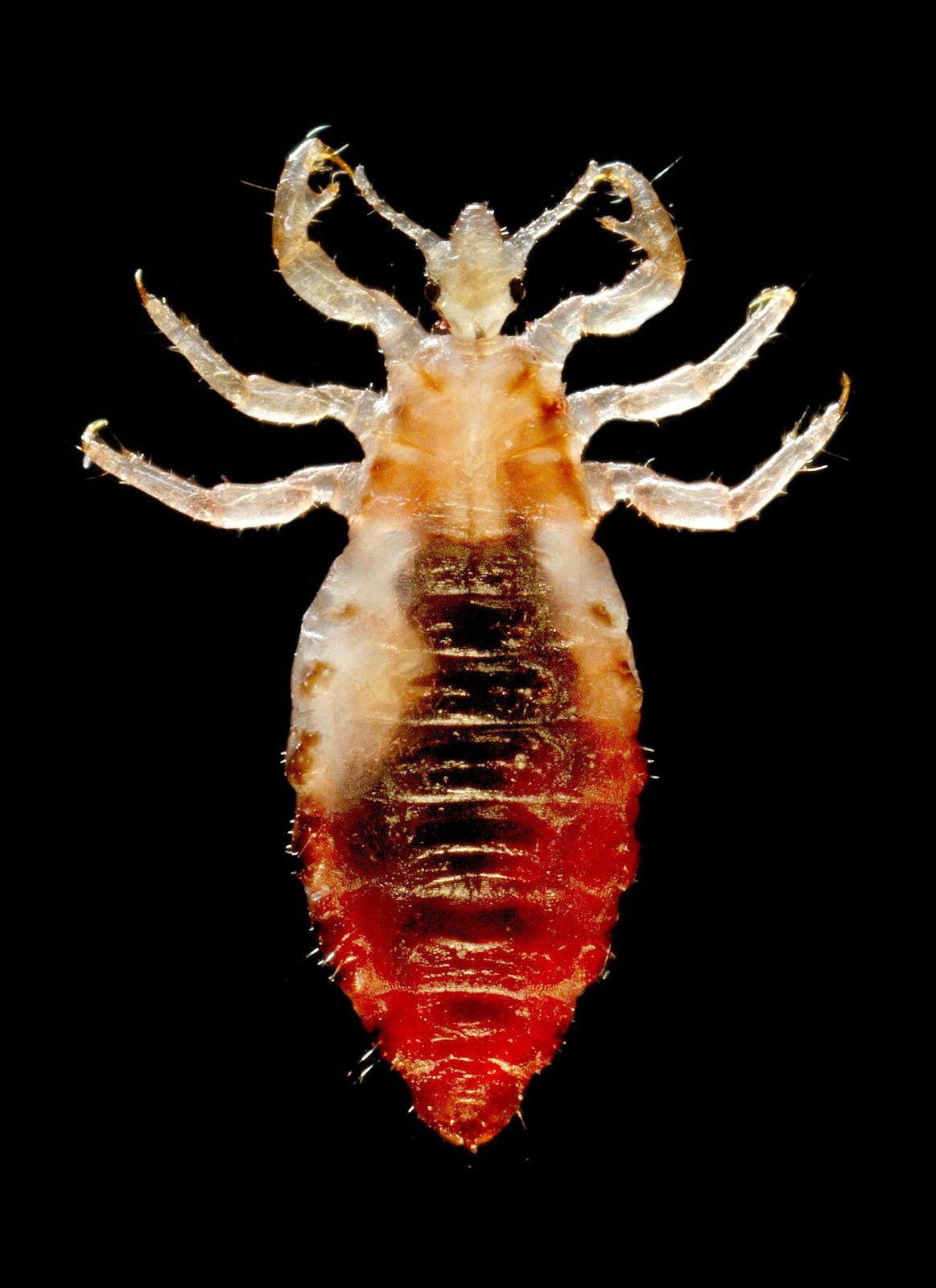 Microscope photograph of a segmented body louse seen from above, with six clawed legs